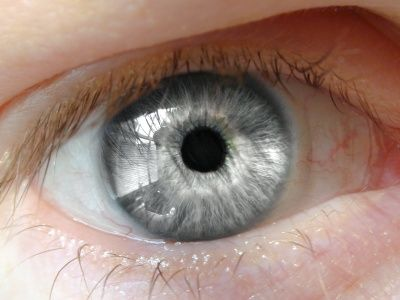 eye5