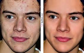Harry Styles Before and After Editing